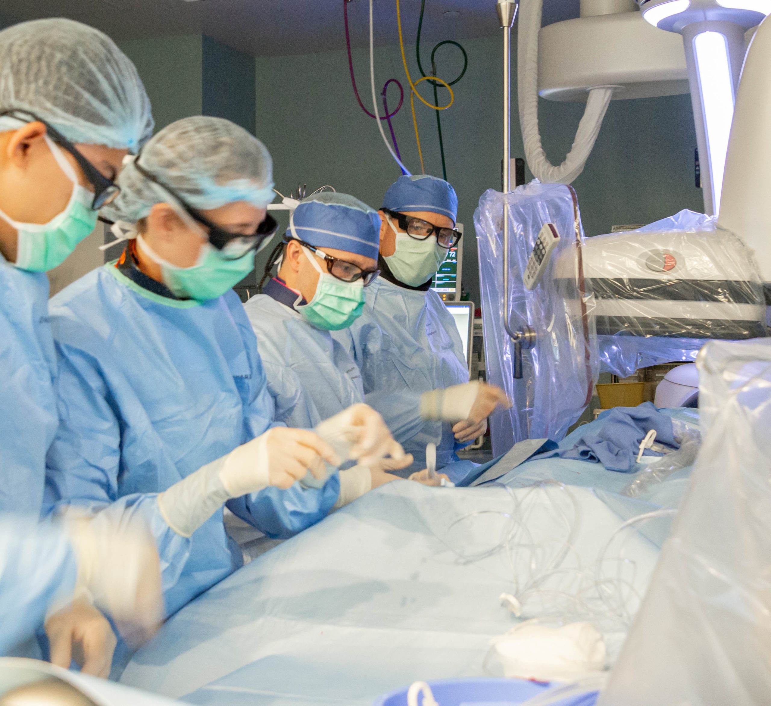 Biplane digital subtraction angiography DSA catheterization suite with neuro-interventional team